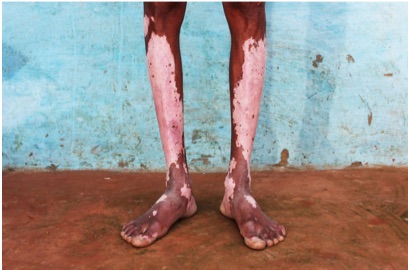 The Toxic Price of Leather in India - image